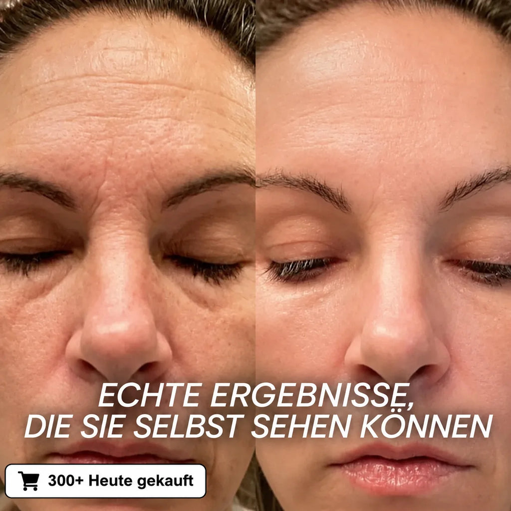 Bio-Kollagen PDRN Aufpolsternder Stick