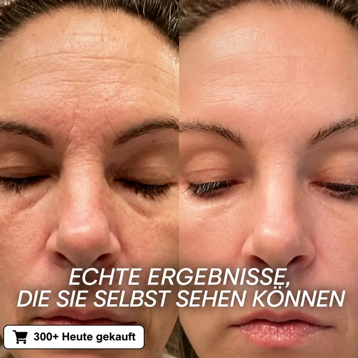 Bio-Kollagen PDRN Aufpolsternder Stick